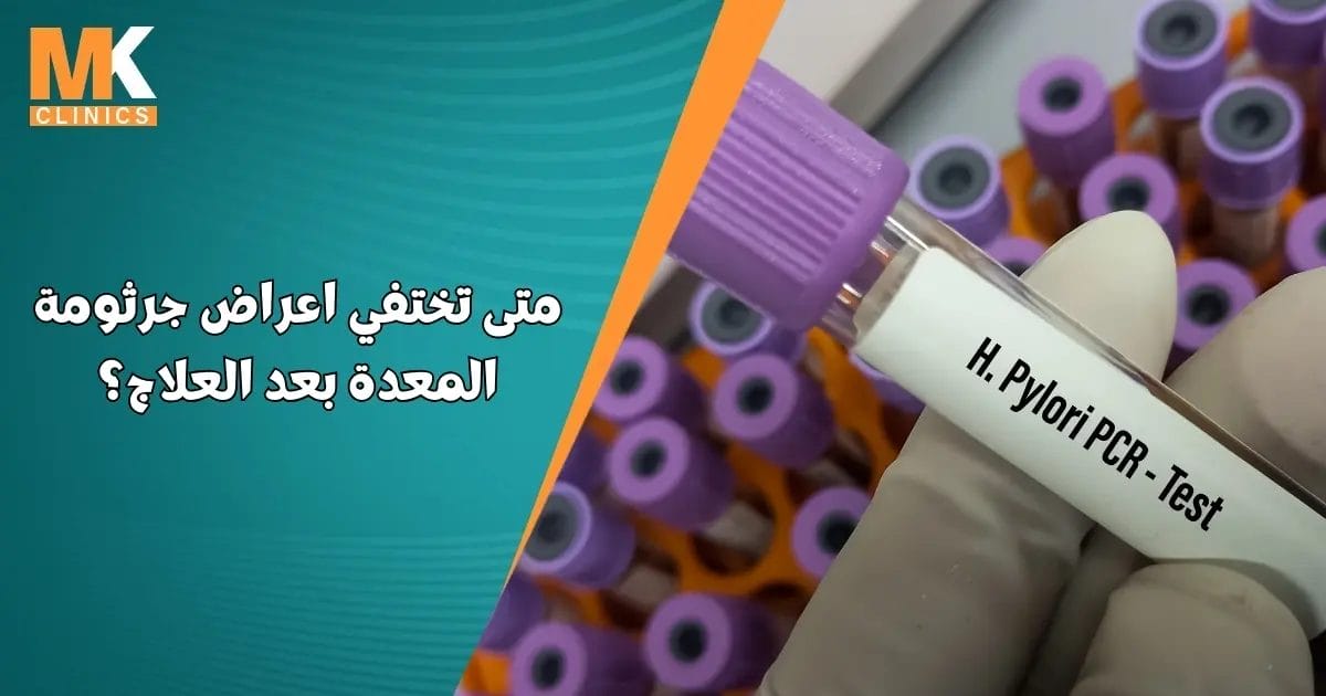 متى تختفي اعراض جرثومة المعدة بعد العلاج