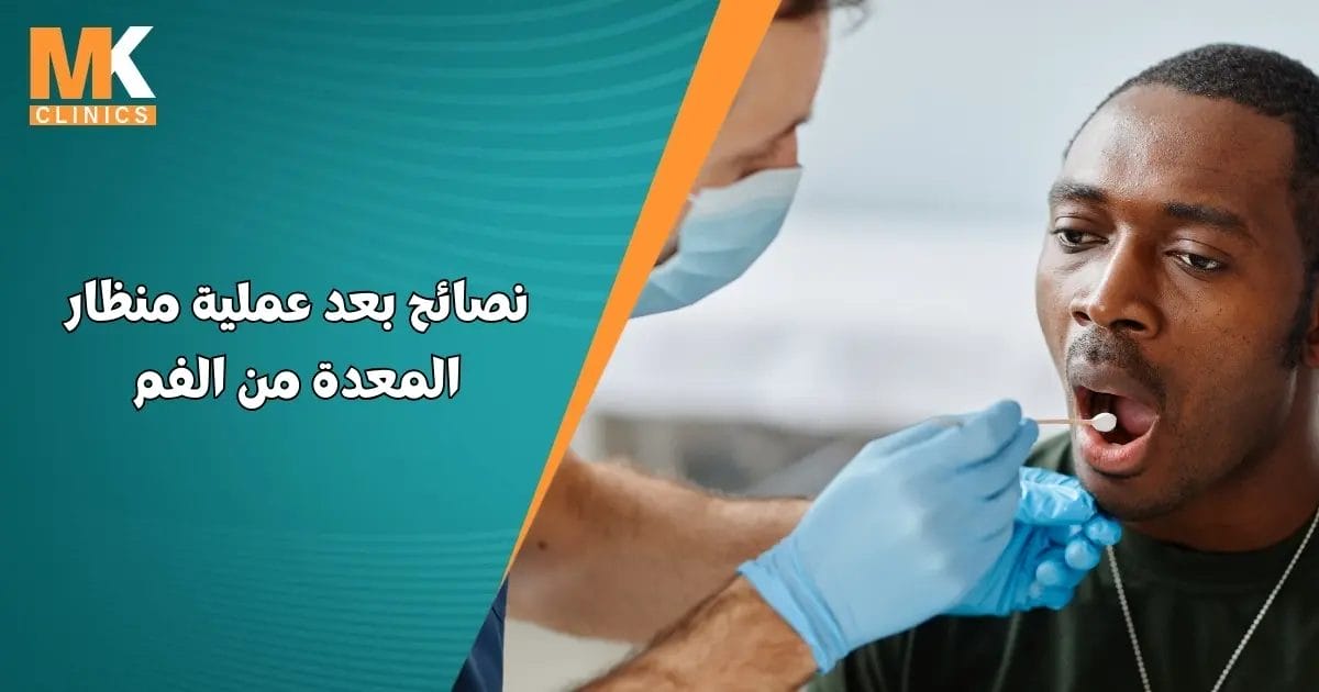 نصائح بعد عملية منظار المعدة من الفم