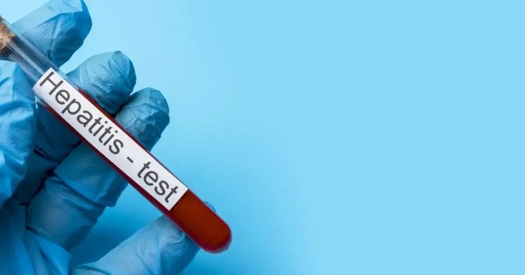 أعراض فيروس سي على الجلد