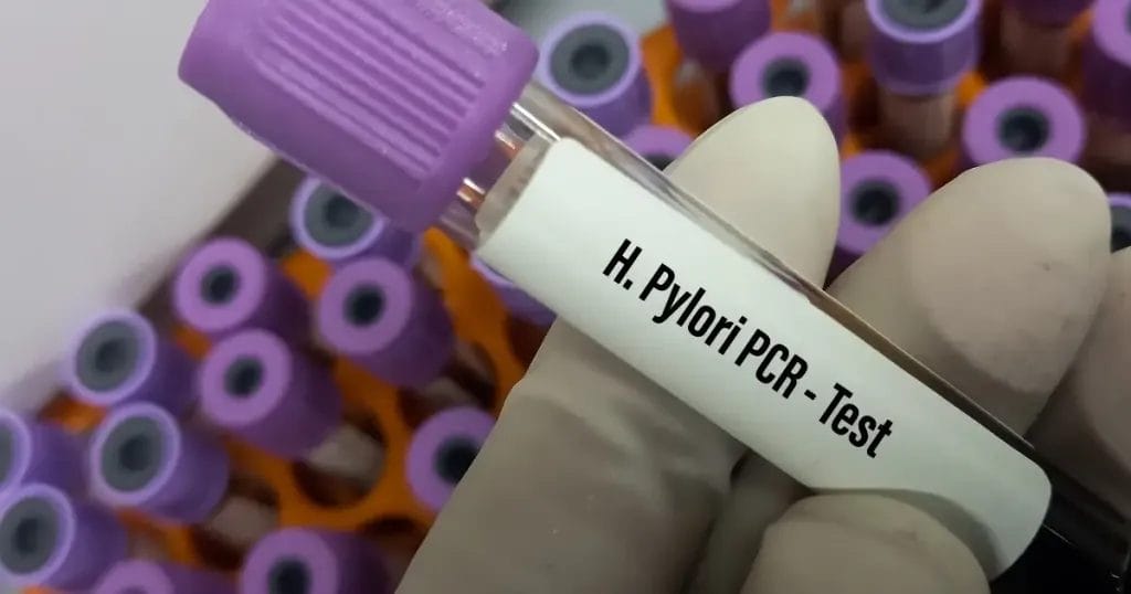 أعراض جرثومة المعدة النفسية وعلاجها