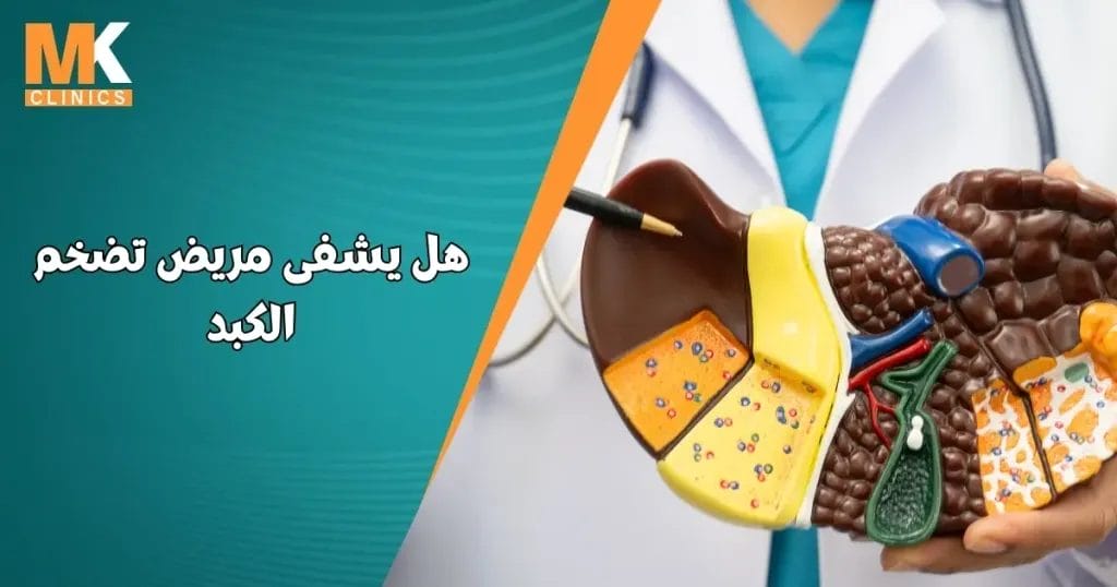 هل يشفى مريض تضخم الكبد