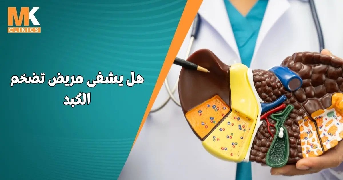 هل يشفى مريض تضخم الكبد