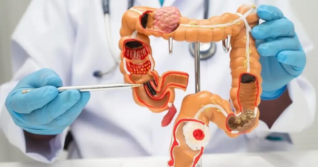 أسباب أمراض الجهاز الهضمي