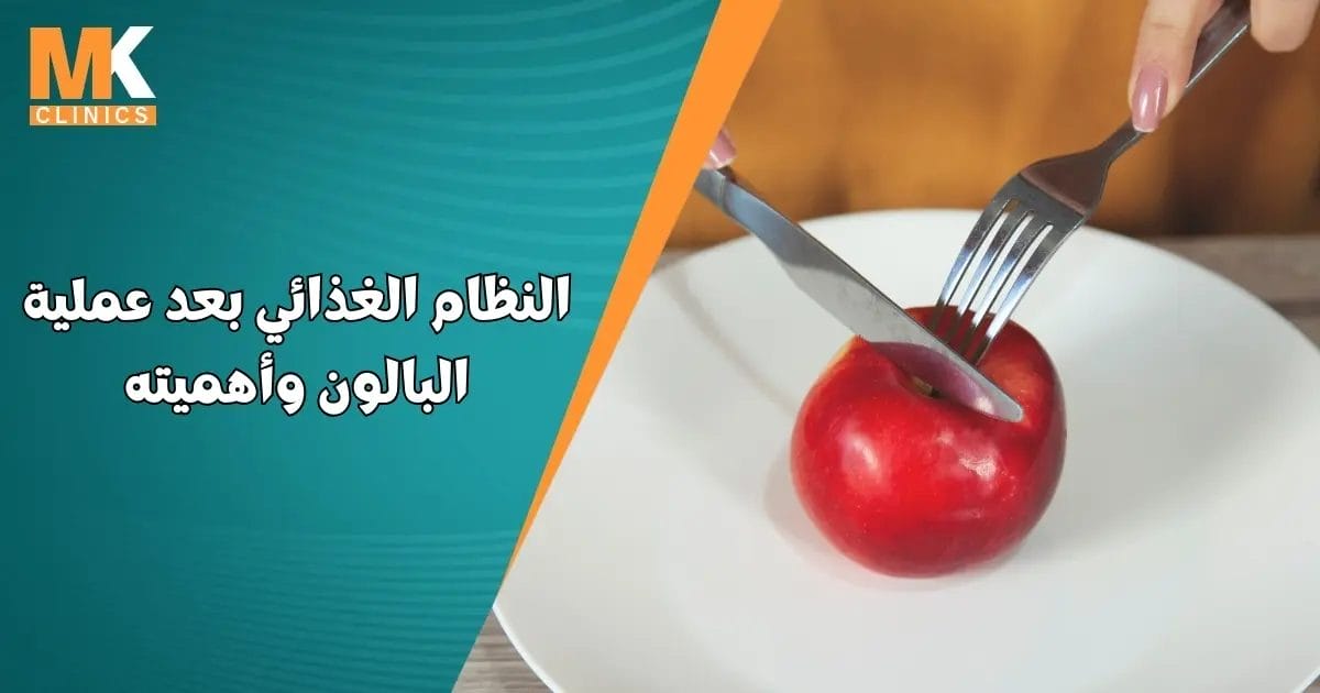 النظام الغذائي بعد عملية البالون