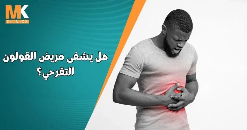 هل يشفى مريض القولون التقرحي