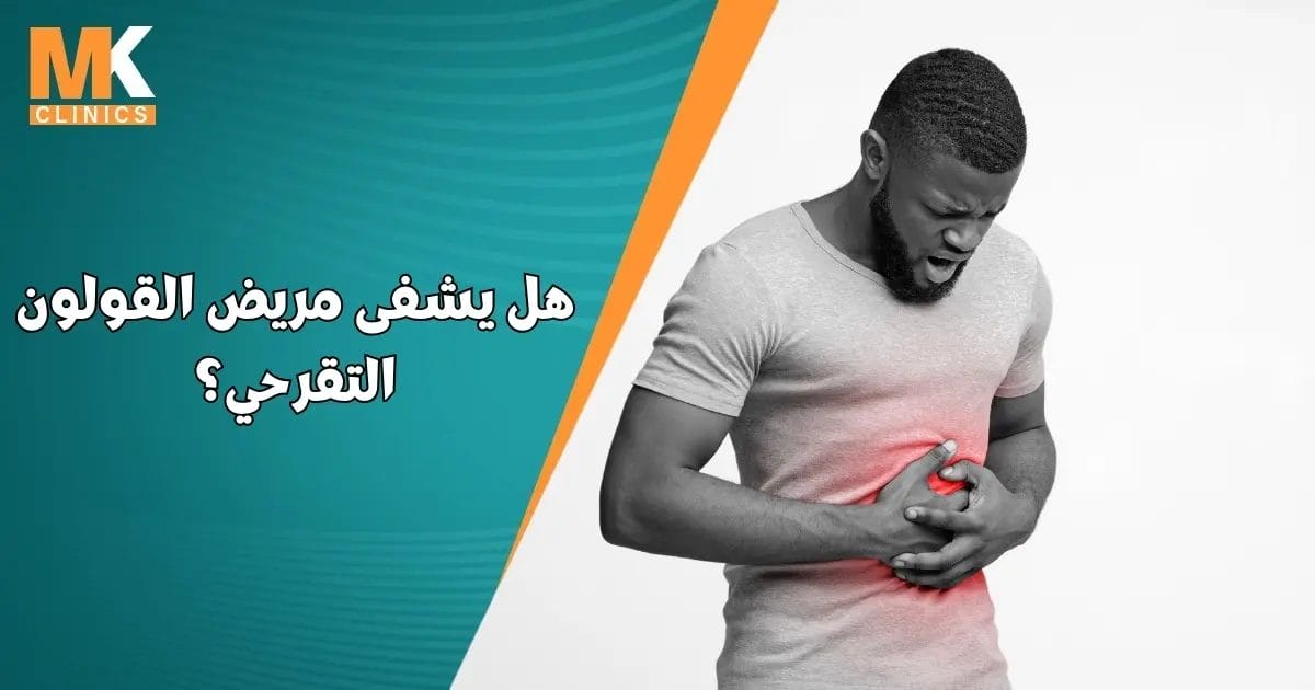 هل يشفى مريض القولون التقرحي