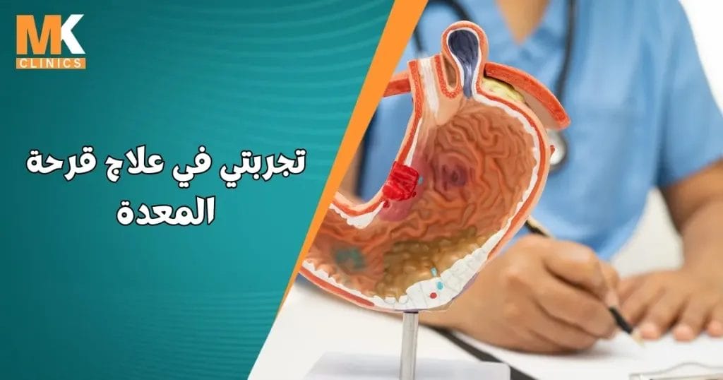 تجربتي في علاج قرحة المعدة