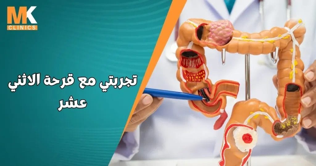 تجربتي مع قرحة الاثني عشر