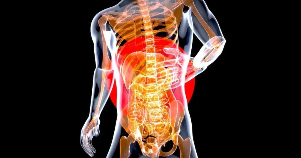 كيف شفيت من قرحة الاثني عشر