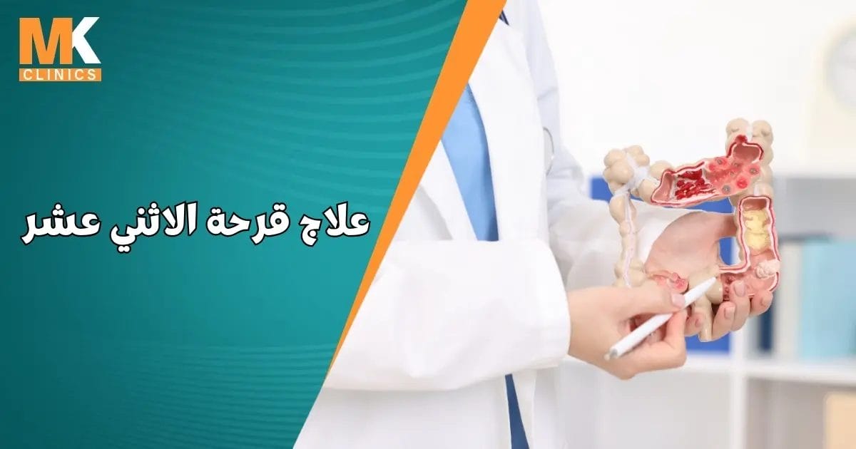 علاج قرحة الاثني عشر
