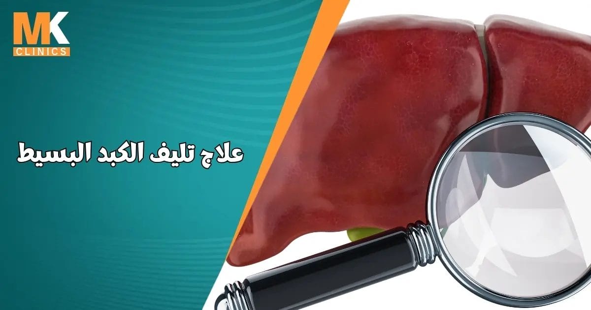 علاج تليف الكبد البسيط